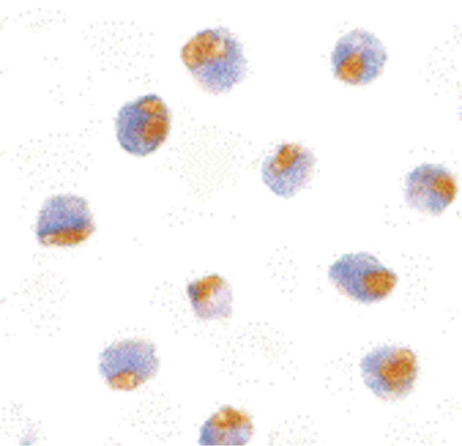 IHC-plus™ Polyclonal Rabbit anti-Human TLR1 Antibody (IHC, WB)