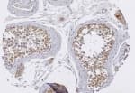 TRIM29 Antibody (aa569-583)
