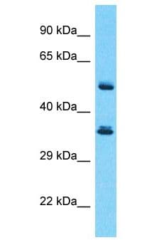 SERPINB3 Antibody (aa167-216)