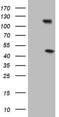 RB1 / Retinoblastoma / RB Antibody (aa309-590, clone OTI11C5)