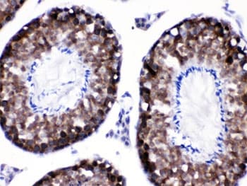 Polyclonal Rabbit anti-Human CACYBP Antibody (IHC, WB)