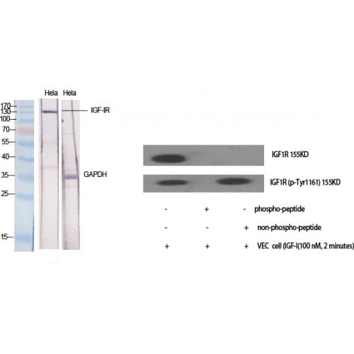 IGF1R / IGF1 Receptor Antibody (1100-1180 aa)