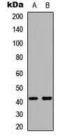 OPRK1 / Kappa Opioid Receptor Antibody (C-Terminus)