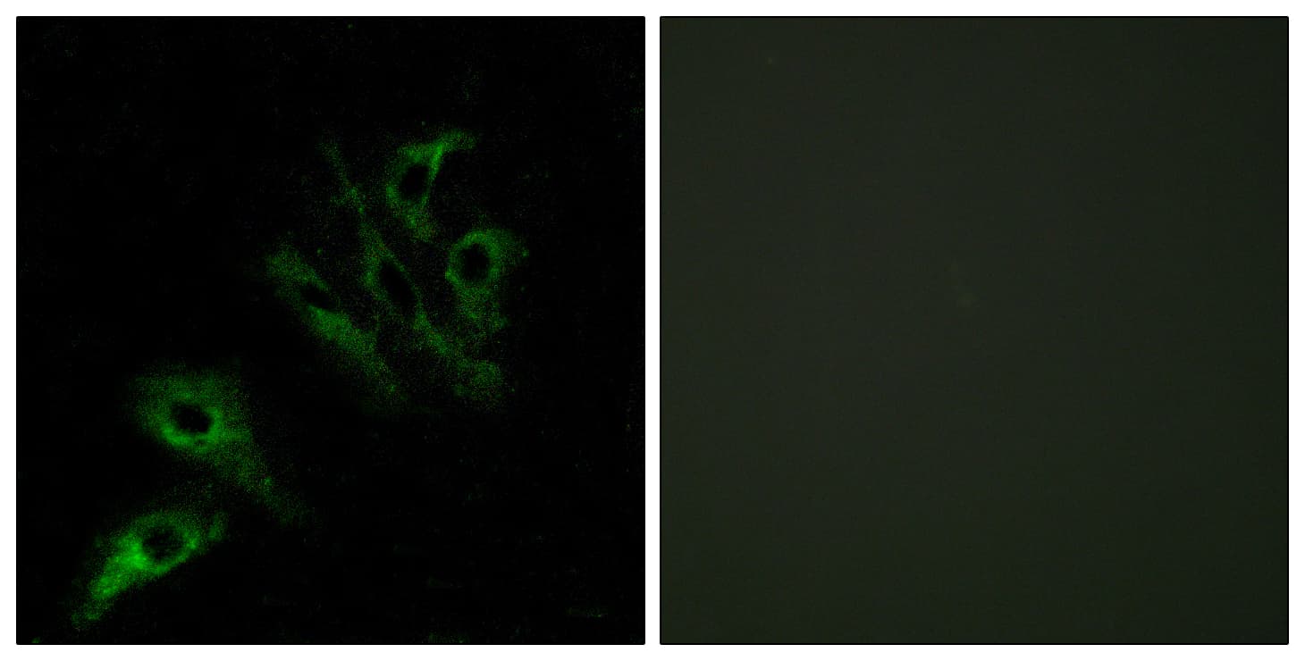 TNFSF4 / OX40L / CD252 Antibody (aa81-130)