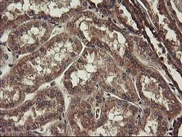 UBE2J1 Antibody (clone OTI3D1)