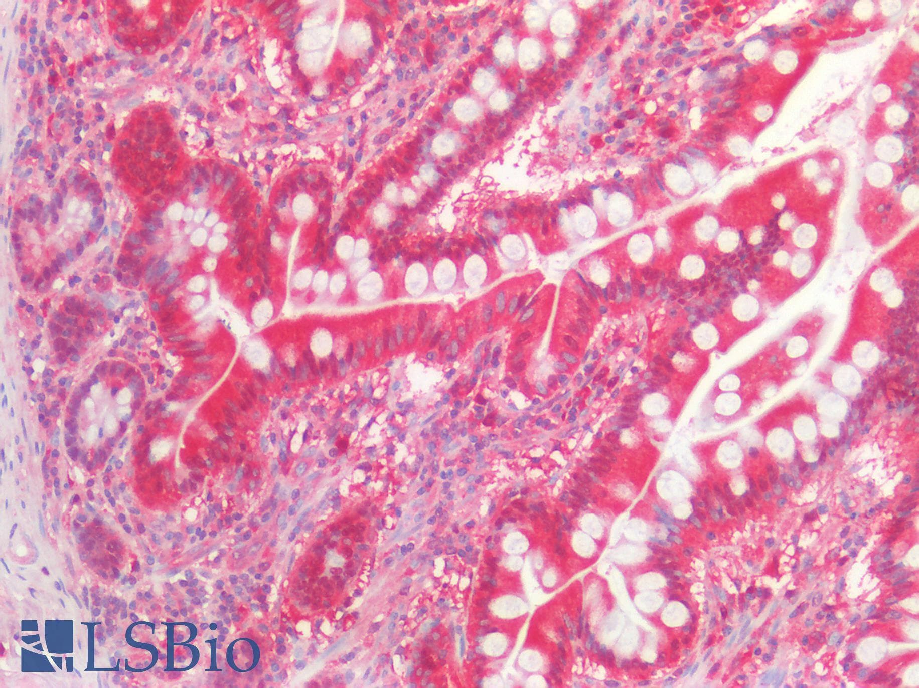 PathPlus™ IDH1 / IDH Antibody (clone AT25H10)