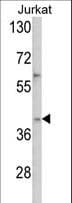 Polyclonal Rabbit anti-Human MSY2 / YBX2 Antibody (aa294-323, IHC, WB)