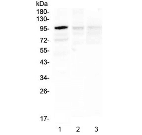 HECTD3 Antibody