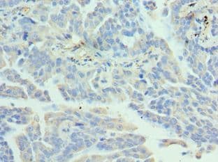 Polyclonal Rabbit anti-Human EZH1 / ENX-2 Antibody (aa160-280, IHC, WB)