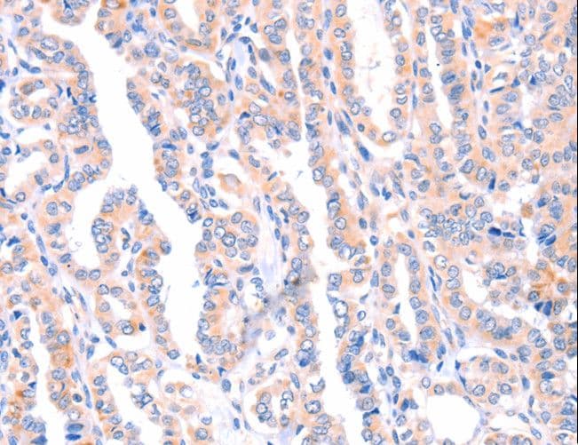 AMPD1 Antibody