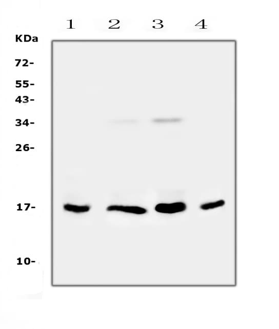 Polyclonal Rabbit anti-Human IL17B Antibody (WB)