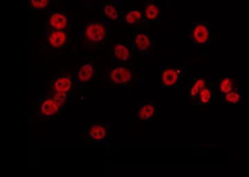 FE65L1 / APBB2 Antibody