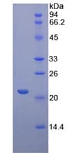 Mouse CD8B / CD8 Beta Protein (Recombinant His-T7)