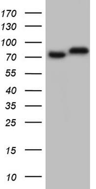 GARS / Glycyl tRNA Synthetase Antibody (clone OTI6C5)