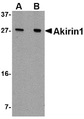 IHC-plus™ Polyclonal Rabbit anti-Human AKIRIN1 Antibody (IHC, WB)
