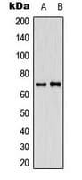Polyclonal Rabbit anti-Human IK3-1 / CABLES1 Antibody (C-Terminus, IHC, IF, WB)
