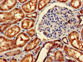Polyclonal Rabbit anti-Human IMMT / Mitofilin Antibody (IHC, IF, WB)