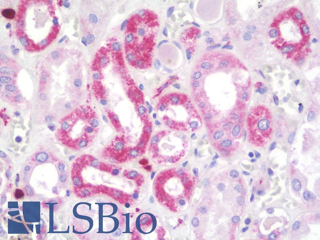 IHC-plus™ NDUFV2 Antibody (aa20-69)
