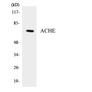 ACHE / Acetylcholinesterase Antibody (aa541-590)