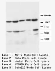 APAF1 / APAF-1 Antibody (N-Terminus)