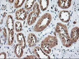 NUDT9 Antibody (clone OTI7A12)