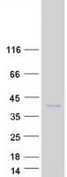 Human PIM3 / PIM-3 Protein (Recombinant Myc-DDK (Flag))