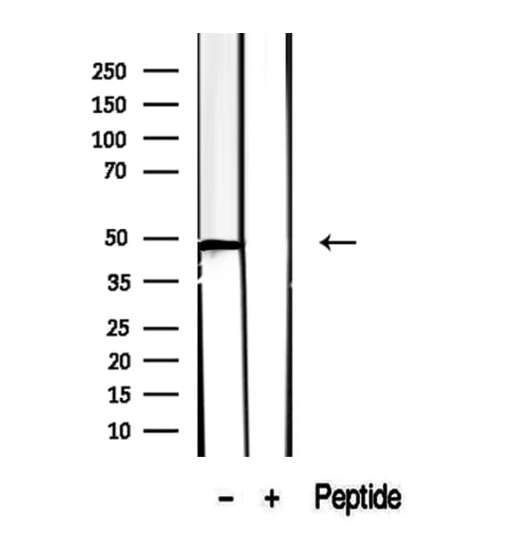CCBL1 Antibody
