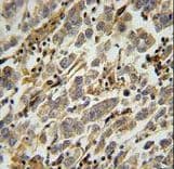 Polyclonal Rabbit anti-Human ASB17 Antibody (aa181-209, IHC, WB)