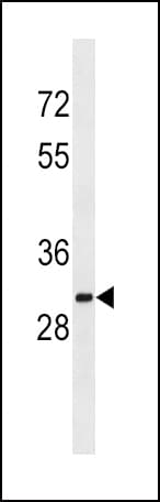 Polyclonal Rabbit anti-Human SULT1A2 / Sulfotransferase 1A2 Antibody (aa258-286, WB)