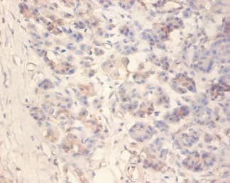 IAPP / Amylin Antibody