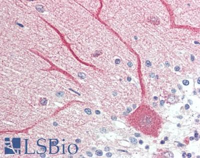HDC / Histidine Decarboxylase Antibody (aa147-178)