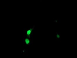 SSX5 Antibody (clone OTI3G6)