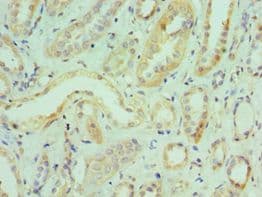 NF90 / ILF3 Antibody (aa785-894)
