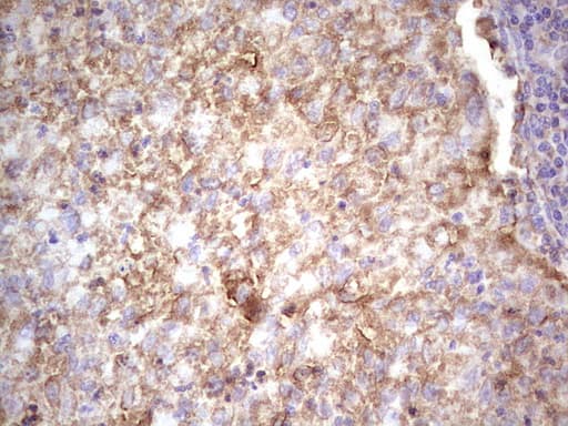 Monoclonal Mouse anti-Human IGF1 Antibody (clone OTI4B12, Carrier-free, aa1-151, IHC, WB)