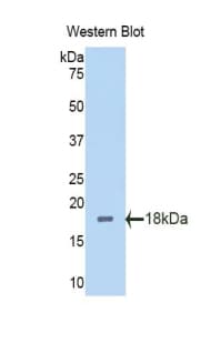 PBRM1 / BAF180 / PB1 Antibody (aa1152-1273, Biotin)