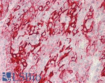 CHID1 Antibody (N-Terminus)