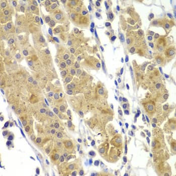 Polyclonal Rabbit anti-Human MMP14 Antibody (IHC, WB)