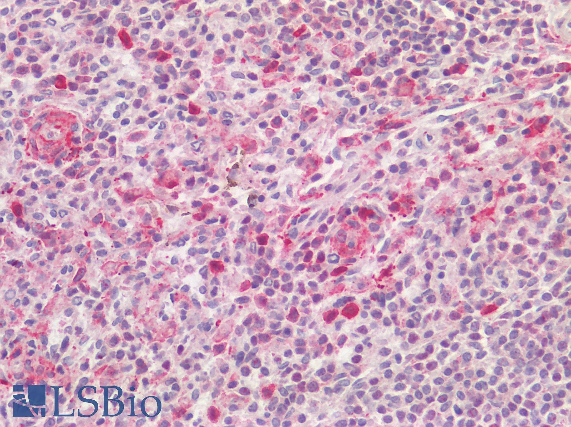 IHC-plus™ AIF1 / IBA1 Antibody (C-terminal domain of human)