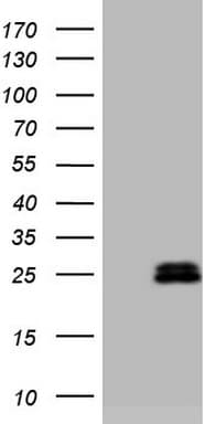 AMTN Antibody (clone OTI2D9)
