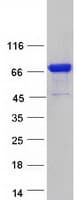 Human KLHL14 Protein (Recombinant Myc-DDK (Flag))