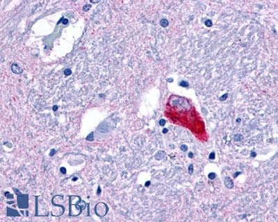 PathPlus™ Polyclonal Rabbit anti-Human GPR35 Antibody (Extracellular Domain, IHC)