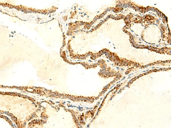 Polyclonal Rabbit anti-Human NAPRT Antibody (IHC)