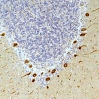 Polyclonal Rabbit anti-Human GHSR / Ghrelin Receptor Antibody (IHC, WB)