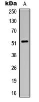 Polyclonal Rabbit anti-Human ALDH3B1 Antibody (Internal, IHC, WB)