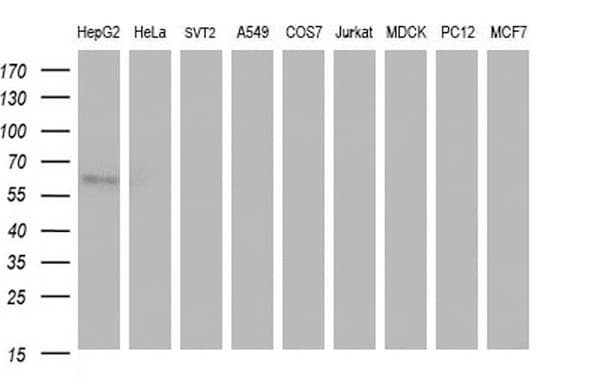 SCARB1 / SR-BI Antibody (clone OTI1E1)