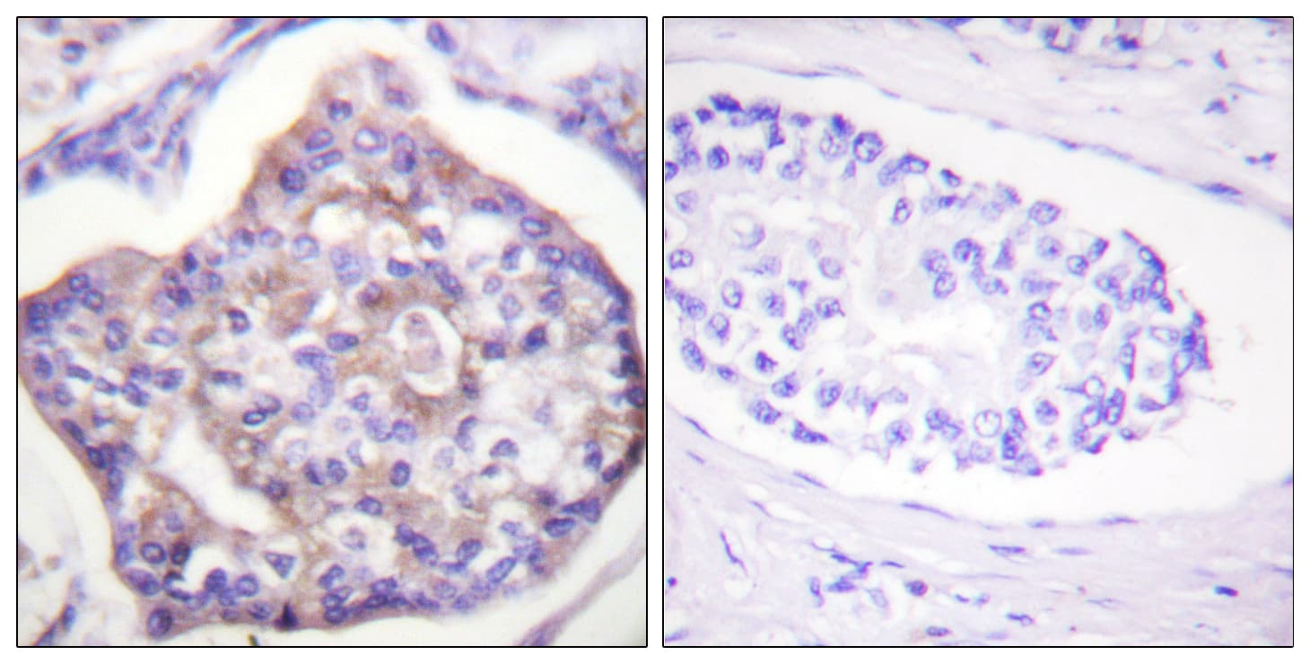 VCL / Vinculin Antibody (phospho-Tyr821)