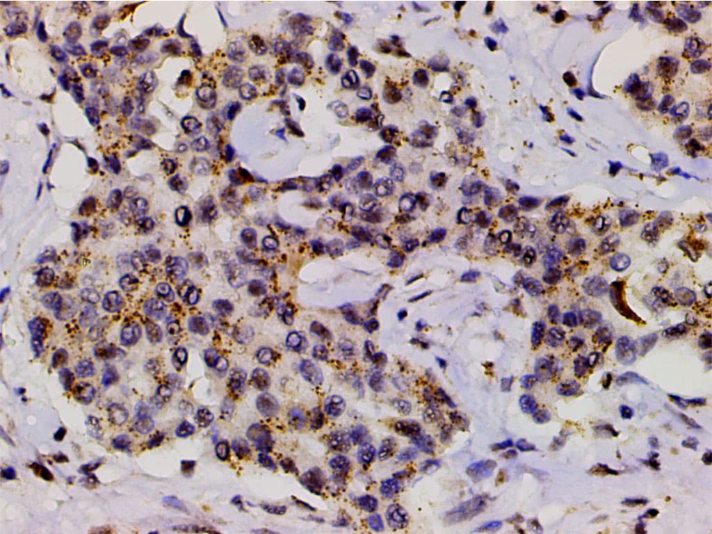 LIMK1 / LIMK Antibody (phospho-Thr508)