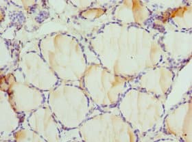 Dipeptidyl Peptidase 3 / DPP3 Antibody