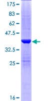 Human SULT1C4 / Sulfotransferase 1C4 Protein (Recombinant GST)