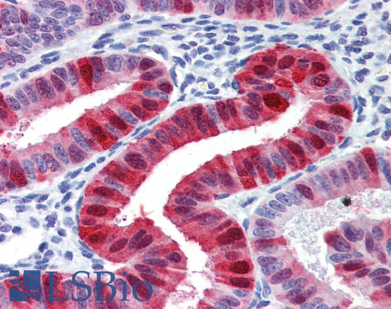 IHC-plus™ Metallothionein Antibody (clone UC1MT)